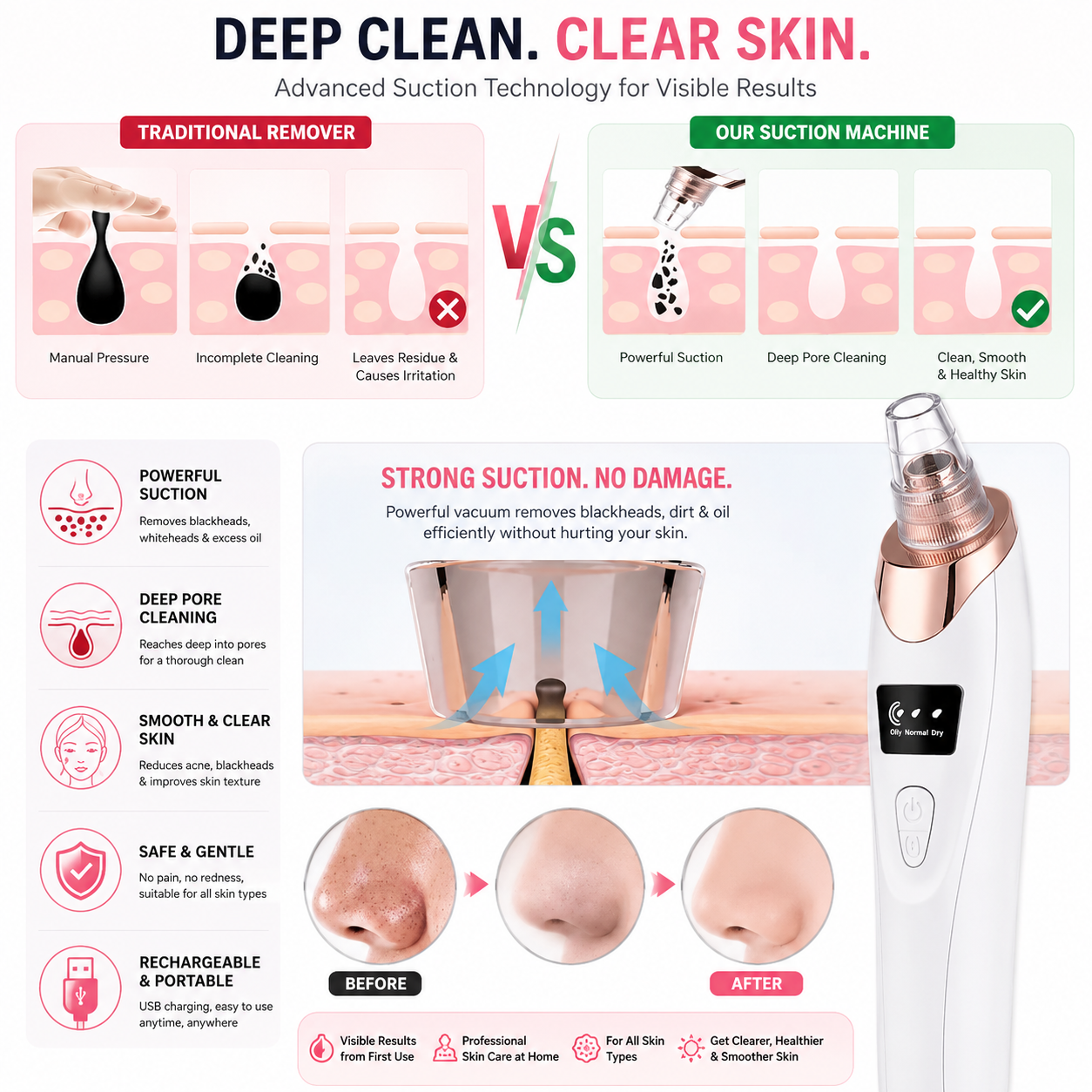 5in1 Blackhead Remover Machine Rechargeable | Face Vacuum Derma Suction With 5 Heads | Blackhead Removing Machine