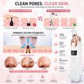 Electric Blackhead Remover | Vacuum Acne & Pore Cleaner | 5 Heads Suction Machine | Skin Care & Exfoliating Tool